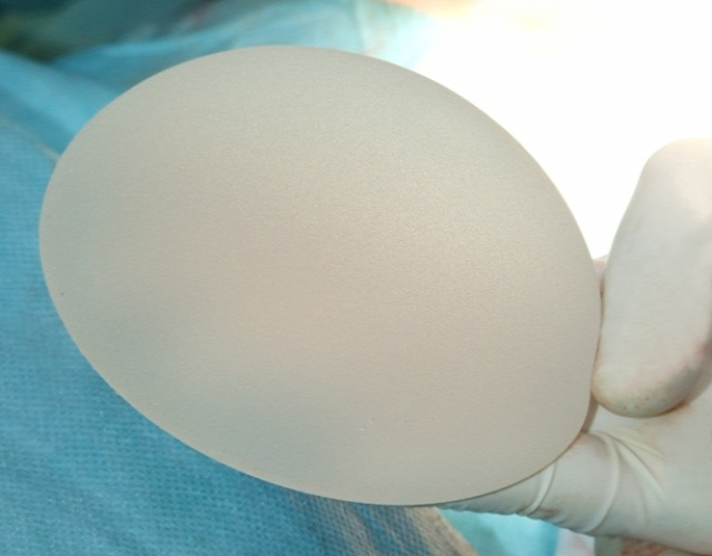 mellnagyobbítás mellimplantátum mellplasztika mellműtét plasztikai beavatkozás plasztikai sebész
