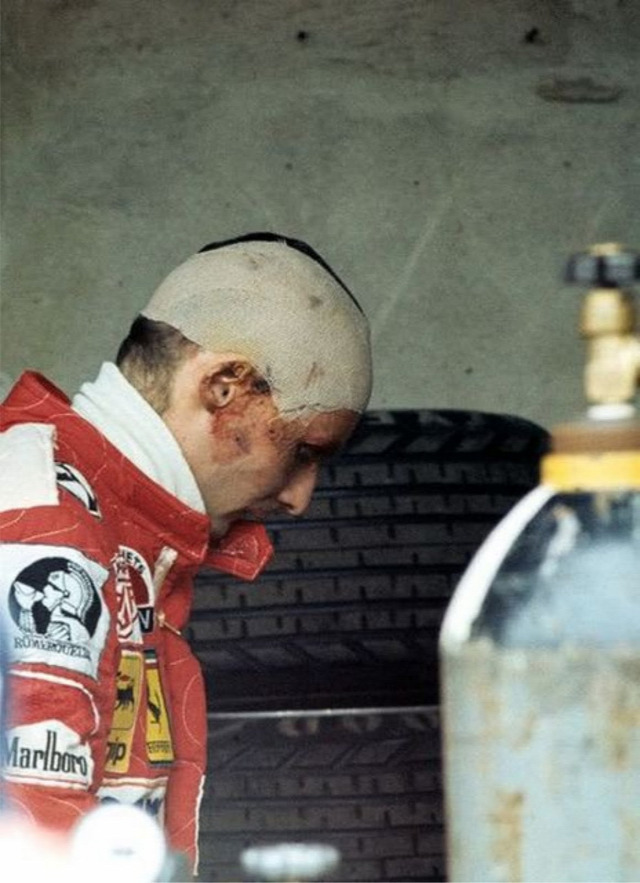 Niki Lauda tüdő-transzplantáció baleset Nürburgring
