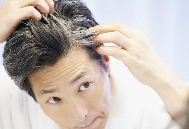 fejbőr hajhullás kopaszodás hajveszteség hajgyérülés hajátültetés hairhungary korpa egészséges fejbőr fejbőrhámlás viszketés prp-terápia