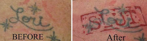 Isten állatkertje tatoo tetoválás szakítás módosítás