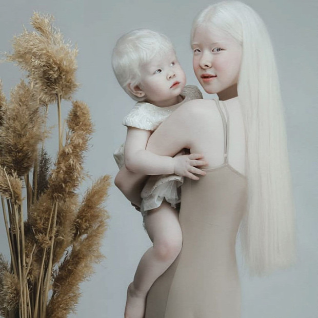 albino lány testvér Kazahsztán