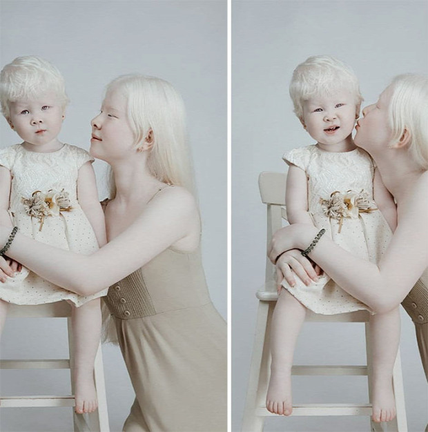 albino lány testvér Kazahsztán