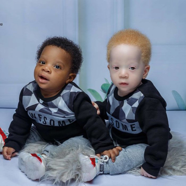 ikrek albino fekete