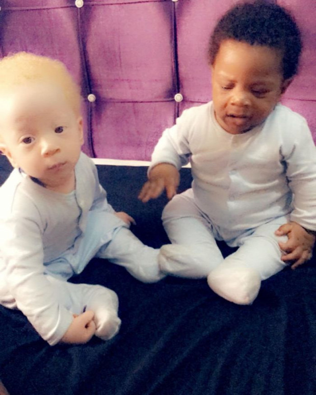 ikrek albino fekete