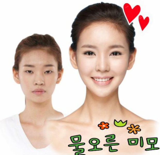 A világ érdekes Dél-Korea plasztikai műtét