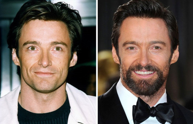 A világ érdekes előtt és után szakáll híres színész
