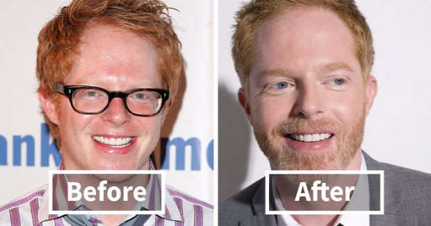 A világ érdekes előtt és után szakáll híres színész