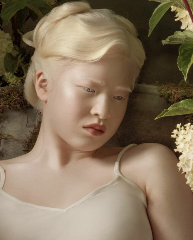 albinó lány kínai modell