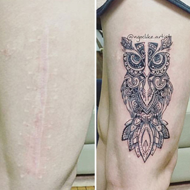 tetoválás sebhely sérülés heg elrejtés
