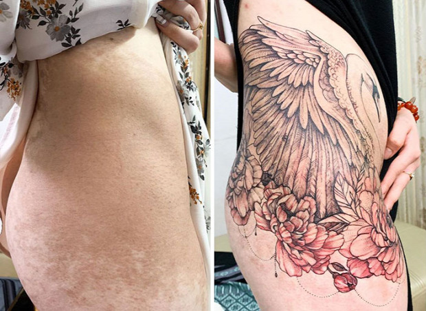tetoválás heg seb sebhely