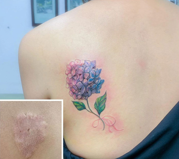 tetoválás sebhely sérülés heg elrejtés