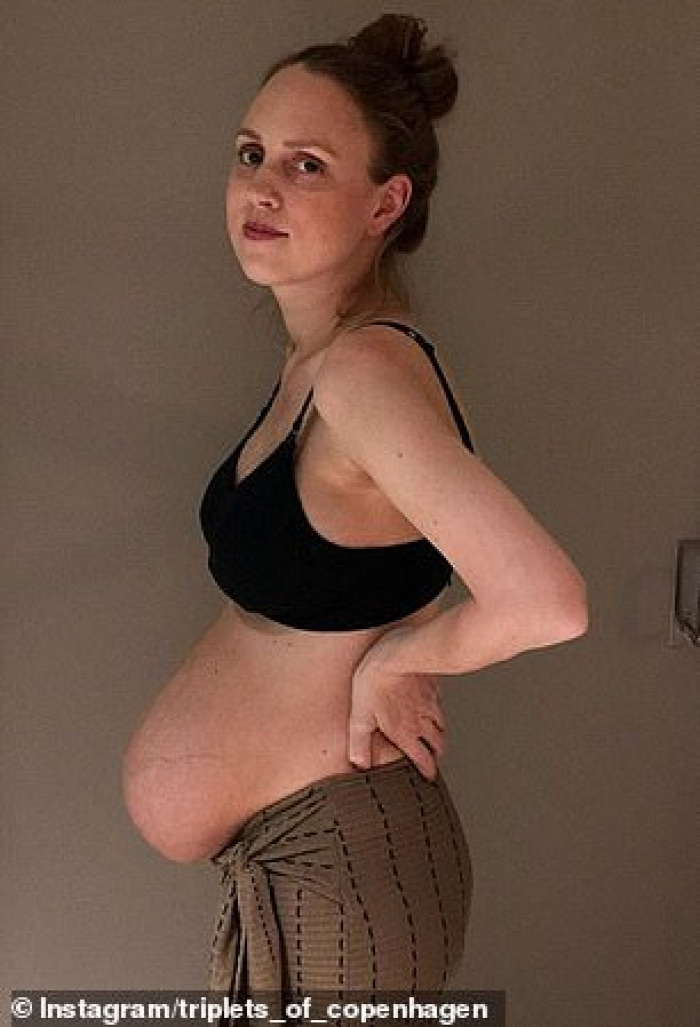 terhesség várandósság testkép testi változások top10