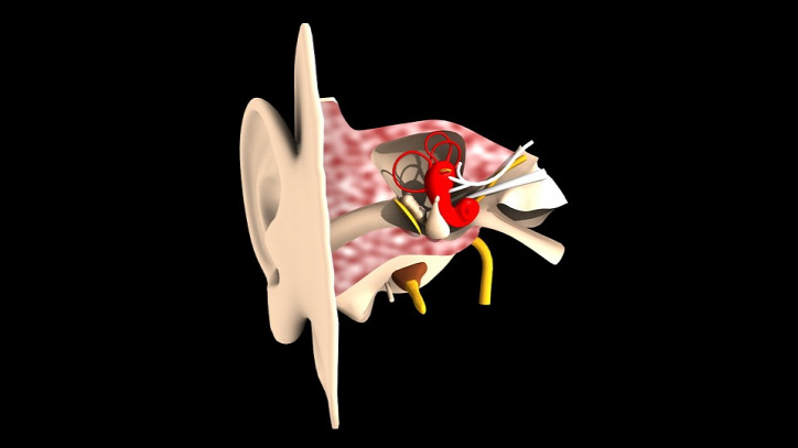 fülzúgás tinnitusz természetes gyógymód