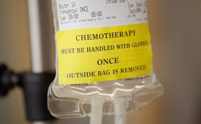 egészség daganat kemoterápia
