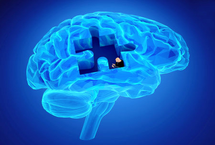egészség Alzheimer-kór demencia megelőzés tünetek teszt szakértő neurológus