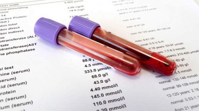 egészség vérvizsgálat szűrővizsgálat vérkép laborlelet