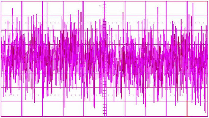egészség egészségünkre rózsaszín zaj pink noise memória test lélek szakértő Dr. Varsányi Attila hangterápia neurológus  szomnológus