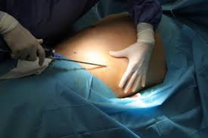 egészség egészségünkre test korrekciós műtétek mellplasztika zsírleszívás szakértő  interjú plasztikai sebész Dr. Grigalek Gábor