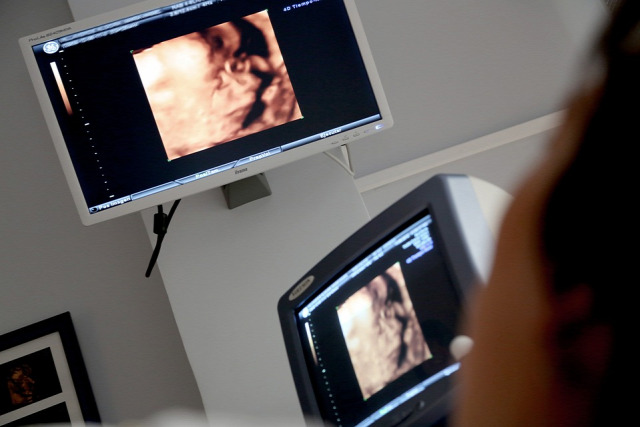 terhesség méhszáj cukorterhelés vércukor genetika ultrahang védőnő toxoplazma babamozi