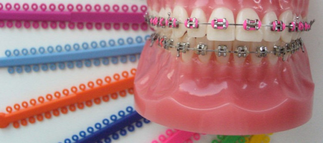 fogorvos fogszabályozó fogszabályozás gyermek fogászat Budapest