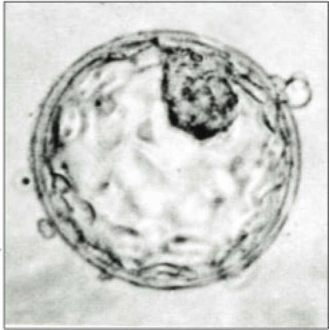 molbiol biológia élettudomány orvosbiológia CRISPR géntechnológia IVF
