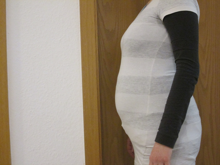 Zizik terhesnapló terhesség kismama külföld