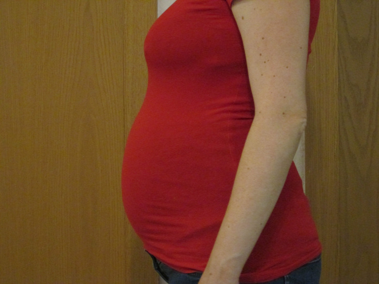 Zizik terhesnapló terhesség kismama ultrahang
