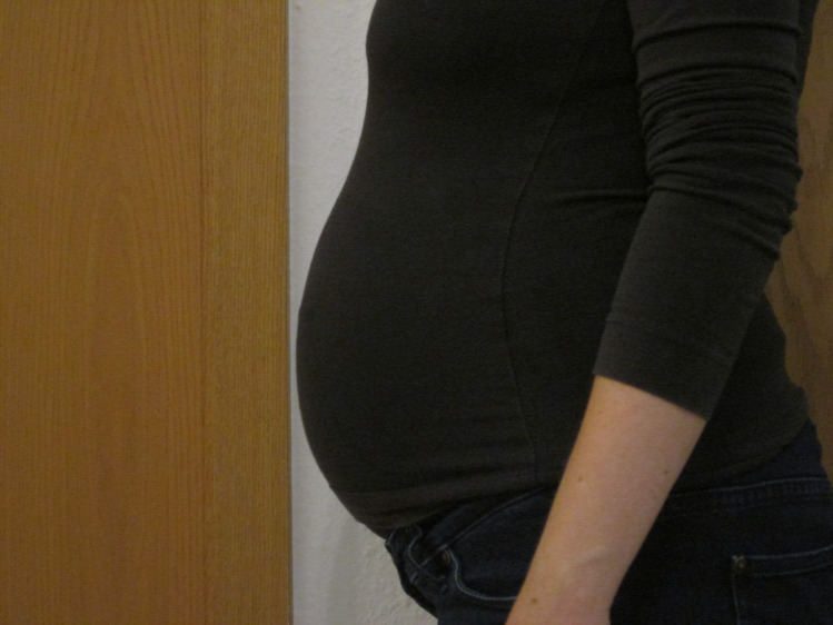 Zizik terhesnapló terhesség kismama utazás