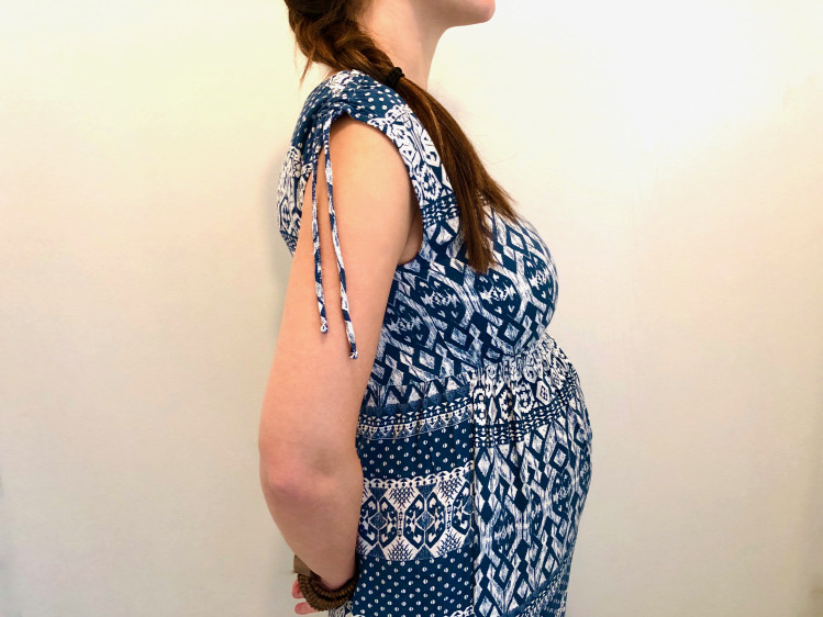 terhesség kismama terhesnapló migrén Shadow