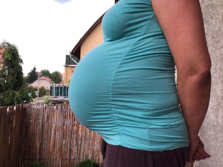 Betti terhesnapló terhesség ikerterhesség