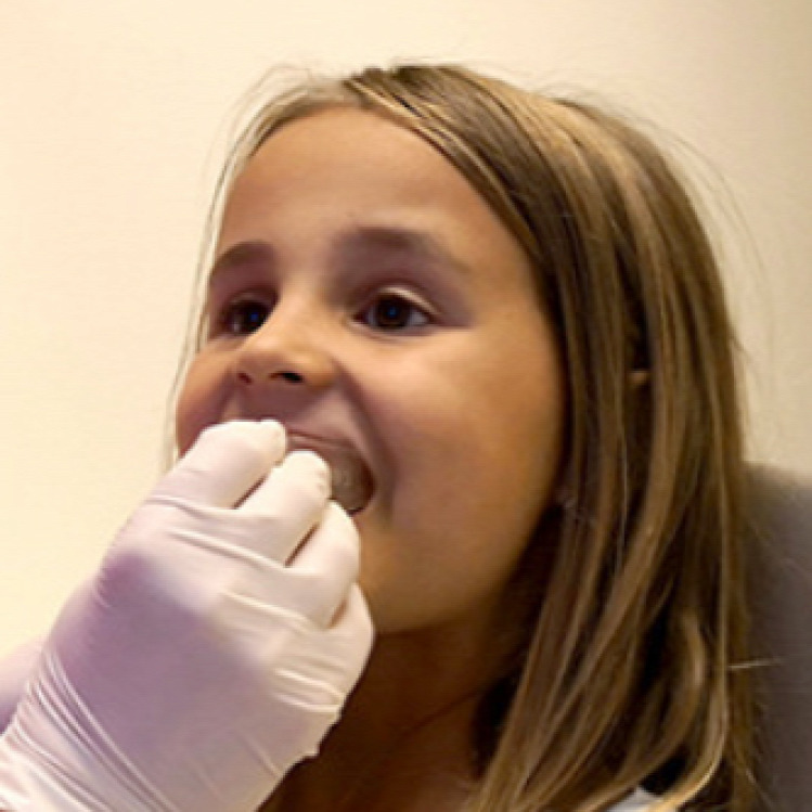 Tünde fogorvos barázdazárás gyermekfogász
