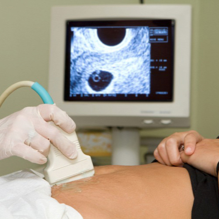 Tünde terhesség terhességi ultrahang kismama