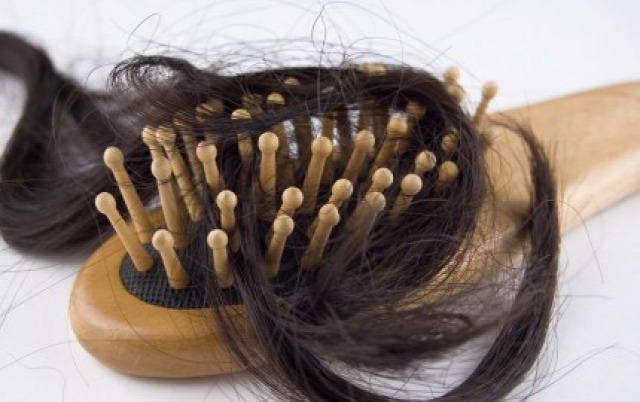 hajhullás kopaszodás öröklés genetika zónás hajhullás átmeneti hajhullás hajkezelés hajátültetés hairhungary kedvezmény betegségek