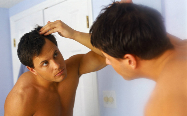 hajbeültetés hajátültetés kopaszodás öröklött kopaszodás hajhullás hairhungary hairhungary klinika előtte-utána fotók képek blog 10% kedvezmény