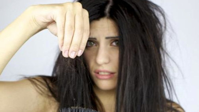 hajhullás kopaszodás genetika hajátültetés hairhungary mezoterápia prp-terápia hajregenerálás hajmosás sampon száraz sampon